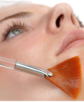Peeling Chimique