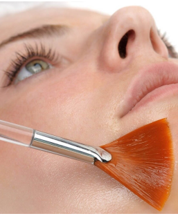 Peeling Chimique