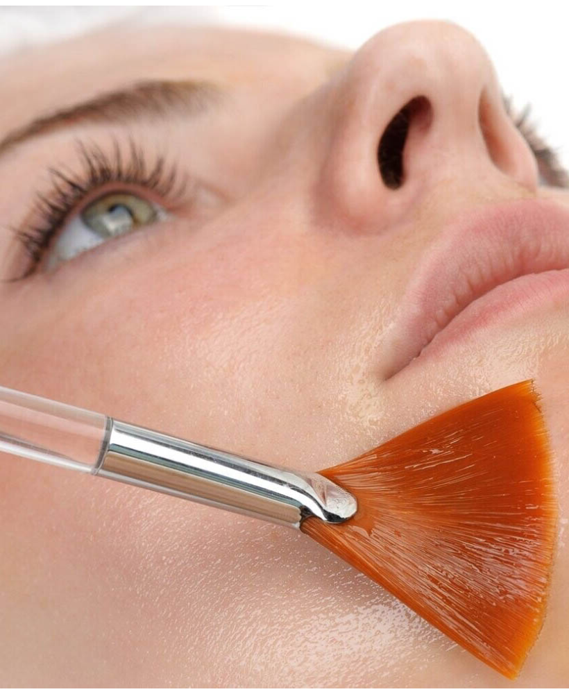 Peeling Chimique