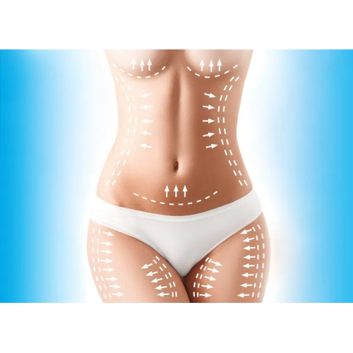 Cryolipolyse